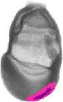 mouse atlas EMAGE spatial in situ gene expression database None