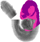 mouse atlas EMAGE spatial in situ gene expression database None