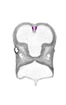 mouse atlas EMAGE spatial in situ gene expression database None