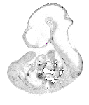mouse atlas EMAGE spatial in situ gene expression database None