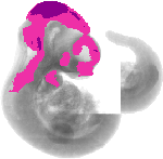 mouse atlas EMAGE spatial in situ gene expression database None