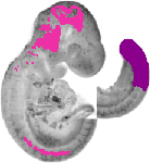 mouse atlas EMAGE spatial in situ gene expression database None