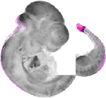 mouse atlas EMAGE spatial in situ gene expression database None
