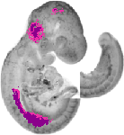 mouse atlas EMAGE spatial in situ gene expression database None