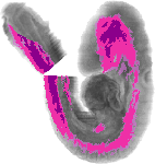 mouse atlas EMAGE spatial in situ gene expression database None