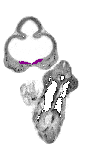 mouse atlas EMAGE spatial in situ gene expression database None