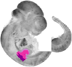 mouse atlas EMAGE spatial in situ gene expression database None