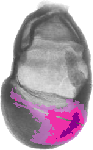 mouse atlas EMAGE spatial in situ gene expression database None