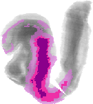 mouse atlas EMAGE spatial in situ gene expression database None