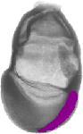 mouse atlas EMAGE spatial in situ gene expression database None