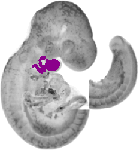 mouse atlas EMAGE spatial in situ gene expression database None