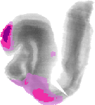 mouse atlas EMAGE spatial in situ gene expression database None