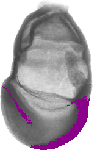 mouse atlas EMAGE spatial in situ gene expression database None