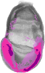 mouse atlas EMAGE spatial in situ gene expression database None