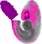 mouse atlas EMAGE spatial in situ gene expression database None