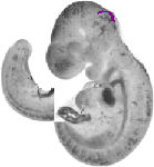 mouse atlas EMAGE spatial in situ gene expression database None