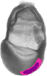 mouse atlas EMAGE spatial in situ gene expression database None