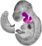 mouse atlas EMAGE spatial in situ gene expression database None