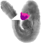 mouse atlas EMAGE spatial in situ gene expression database None