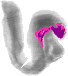 mouse atlas EMAGE spatial in situ gene expression database None