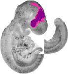 mouse atlas EMAGE spatial in situ gene expression database None