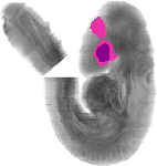 mouse atlas EMAGE spatial in situ gene expression database None