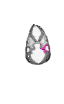 mouse atlas EMAGE spatial in situ gene expression database None