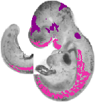 mouse atlas EMAGE spatial in situ gene expression database None