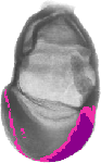 mouse atlas EMAGE spatial in situ gene expression database None