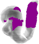 mouse atlas EMAGE spatial in situ gene expression database None