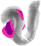 mouse atlas EMAGE spatial in situ gene expression database None