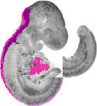 mouse atlas EMAGE spatial in situ gene expression database None