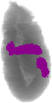 mouse atlas EMAGE spatial in situ gene expression database None
