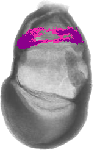 mouse atlas EMAGE spatial in situ gene expression database None