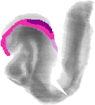 mouse atlas EMAGE spatial in situ gene expression database None