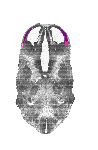 mouse atlas EMAGE spatial in situ gene expression database None
