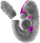 mouse atlas EMAGE spatial in situ gene expression database None