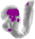 mouse atlas EMAGE spatial in situ gene expression database None