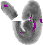 mouse atlas EMAGE spatial in situ gene expression database None