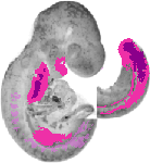 mouse atlas EMAGE spatial in situ gene expression database None