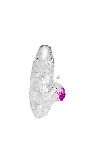 mouse atlas EMAGE spatial in situ gene expression database None