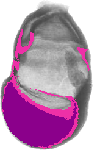 mouse atlas EMAGE spatial in situ gene expression database None