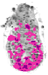mouse atlas EMAGE spatial in situ gene expression database None