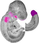mouse atlas EMAGE spatial in situ gene expression database None