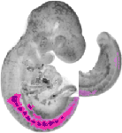 mouse atlas EMAGE spatial in situ gene expression database None