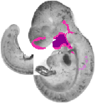 mouse atlas EMAGE spatial in situ gene expression database None