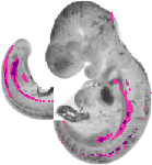 mouse atlas EMAGE spatial in situ gene expression database None
