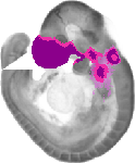 mouse atlas EMAGE spatial in situ gene expression database None