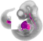 mouse atlas EMAGE spatial in situ gene expression database None