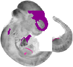mouse atlas EMAGE spatial in situ gene expression database None